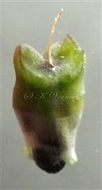  Pyxidium